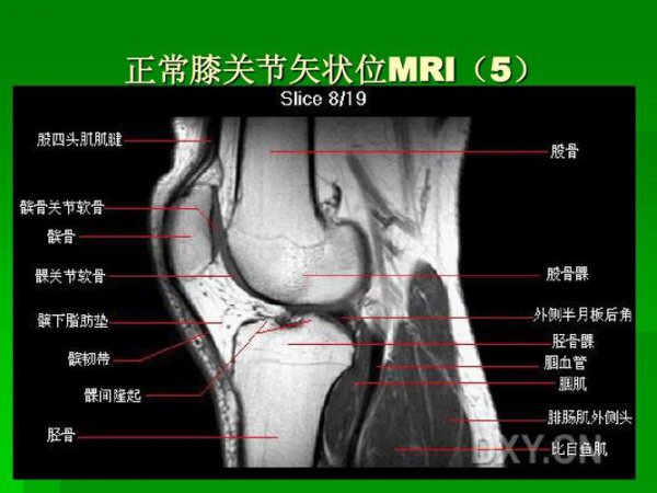 全身骨关节MRI解剖：从基础到精通 全30讲 - 膝关节MRI解剖图示
