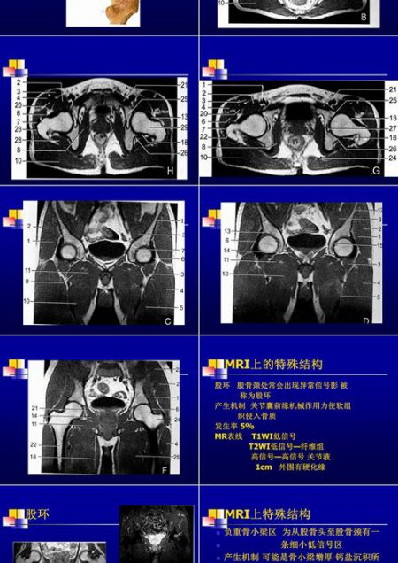 全身骨关节MRI解剖:从基础到精通 全30讲 - 髋关节MRI解剖图示