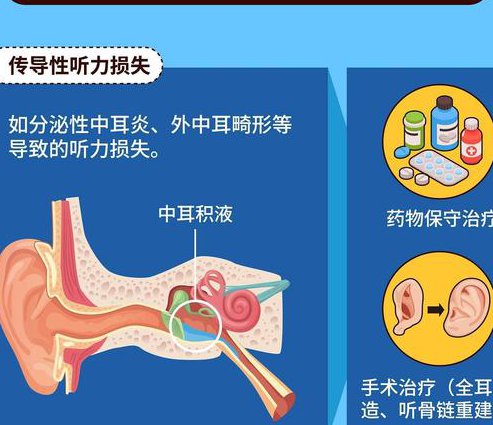 英语中高级口语听力全套视频课程 - 听力