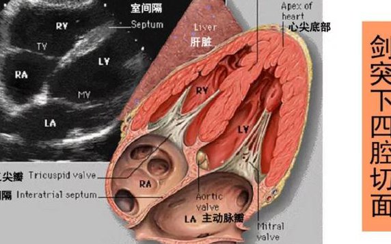 了解我们的心脏结构3d演示 - 心脏剖面