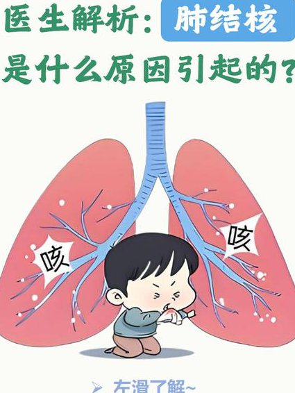 肺结核专题教学视频 - 肺结核症状