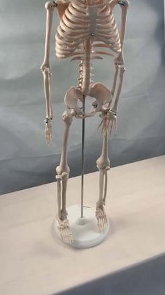中山大学人体解剖学（36课 ） - 人体骨骼标本