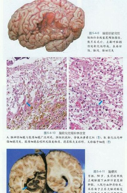 【四川大学】法医学（全62讲）教学视频 - 法医病理