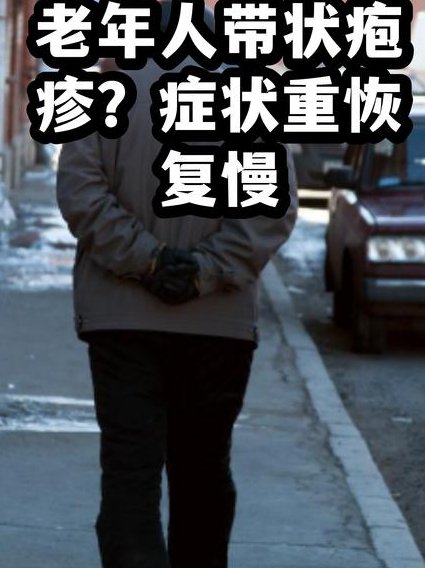 白癜风，看看专家怎么说 - 病症特征