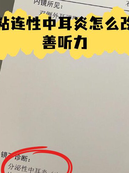 BBC新闻英语听力100篇 - 听力