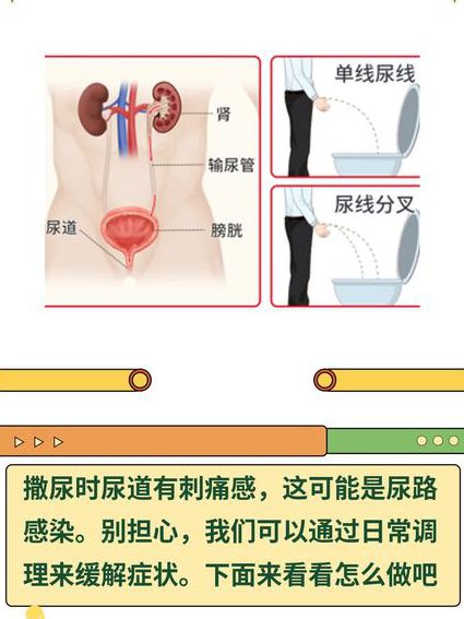 尿道下裂，看看专家怎么说 - 小儿泌尿