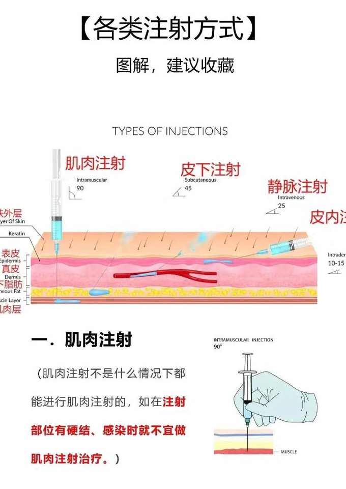 临床基本操作技能教学视频 - 注射技术