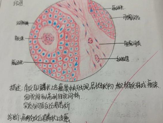 2019考研病理学课程-刘忠宝 - 病理学图谱