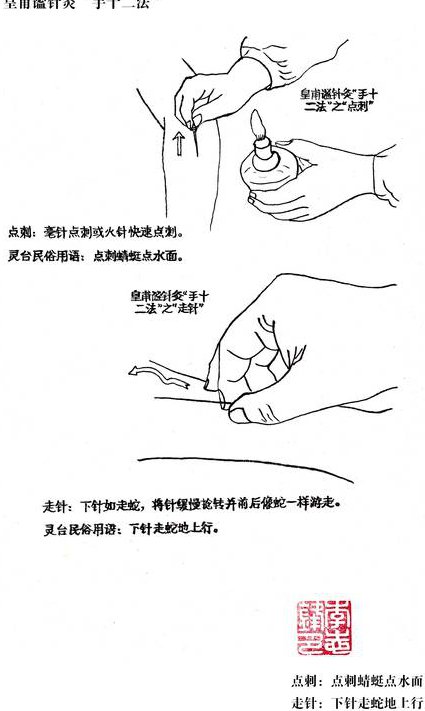 中医执业医师-针灸学() - 针刺手法